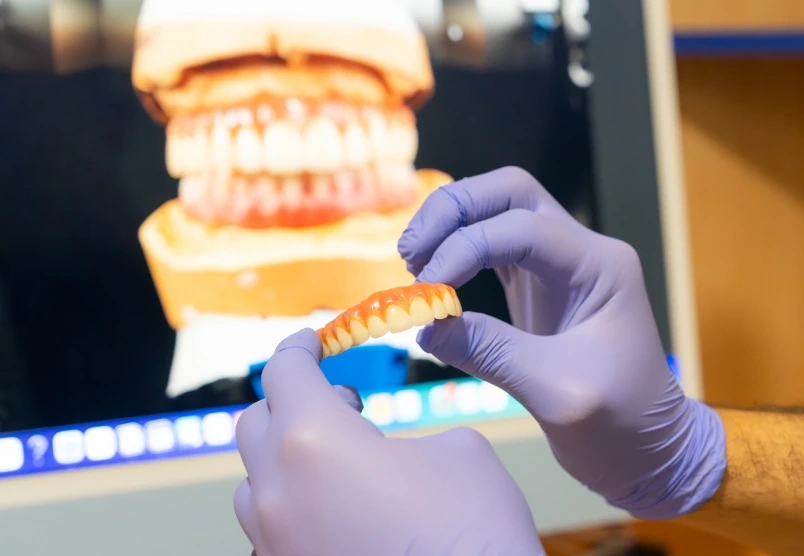 Gloved hands holding a fixed full-arch teeth model in front of an enlarged dental image.