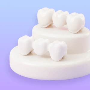 3D illustration of staged treatment steps for an All-on-4 restoration.