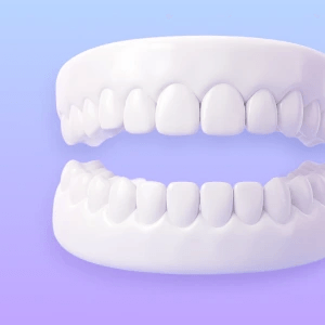 3D illustration of upper and lower dental arches representing treatment for one or both arches.