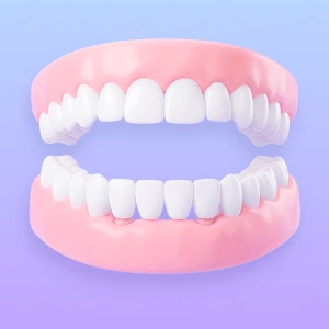 3D illustration of an All-on-4 full-mouth restoration with upper and lower arches.
