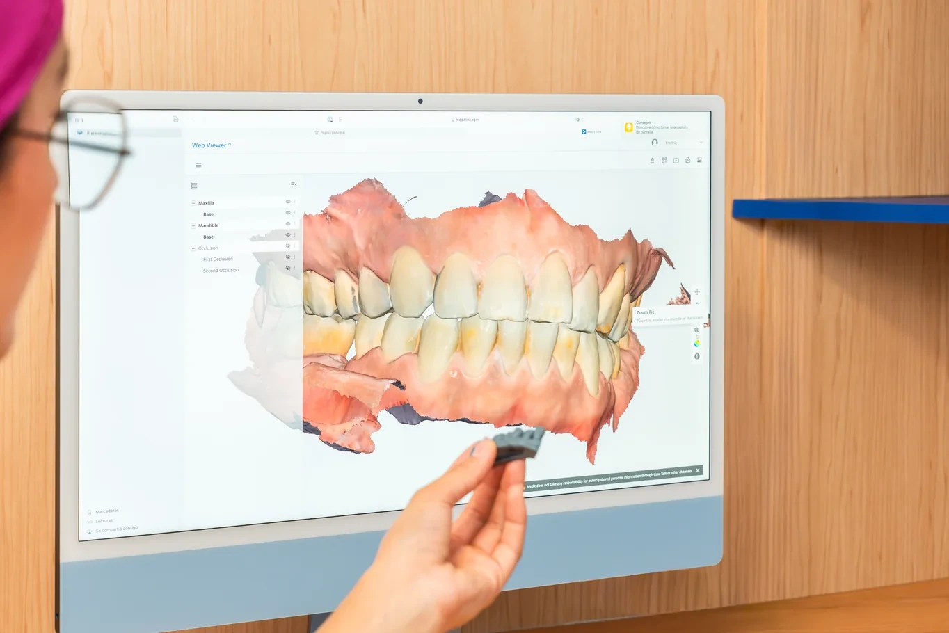 Digital dental model on a clinic screen during implant planning review.