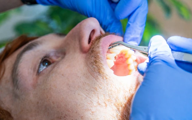 Dentist examining a patient's teeth during an urgent dental evaluation at hisonrisa in Mexico City.