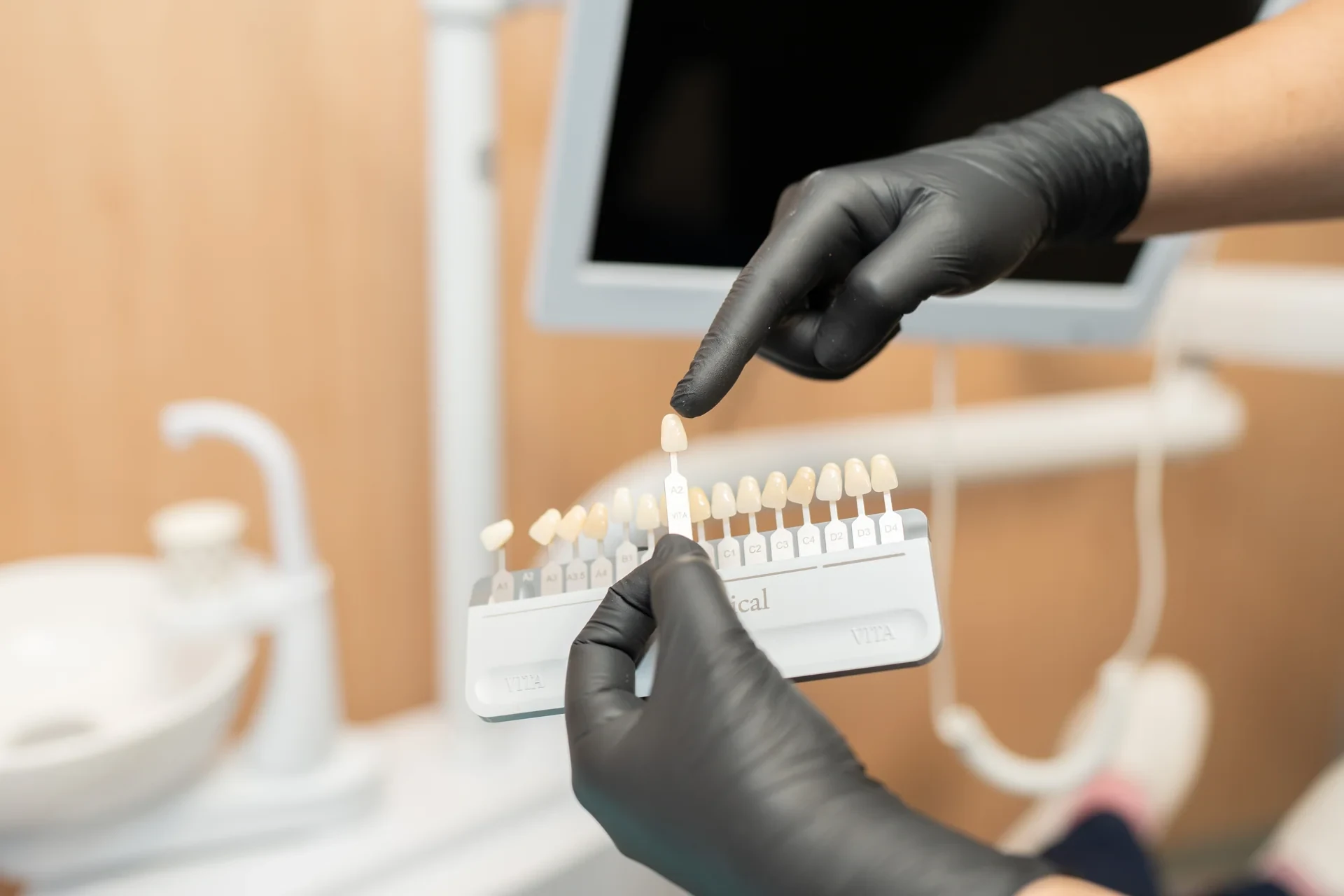 Manos con guantes comparando una muestra de corona con una guía de tonos dentales.