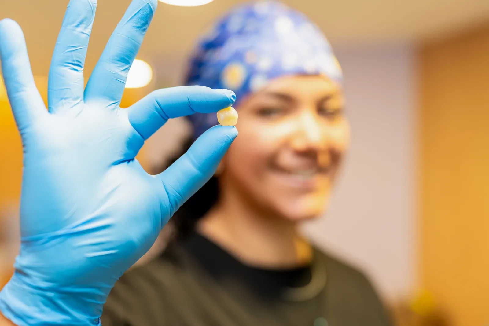 Detalle de una restauración dental usada para explicar posibles opciones después de revisar una muela.