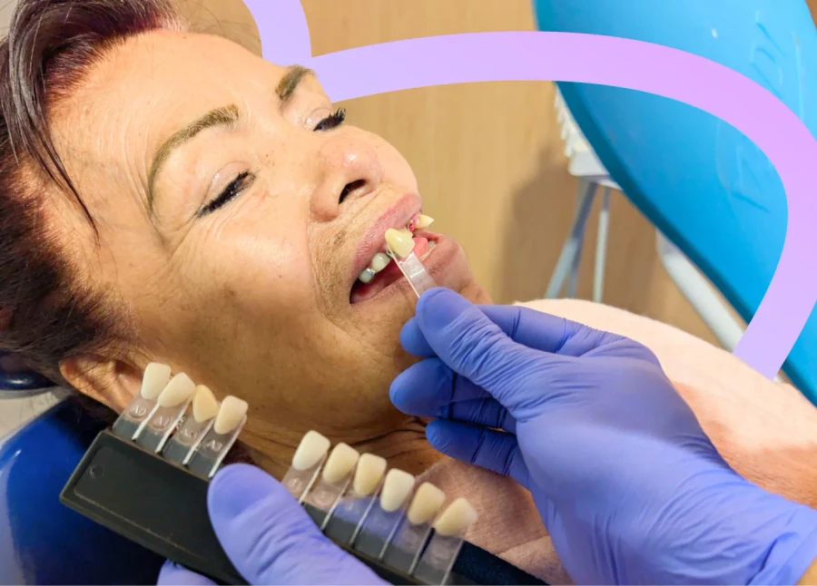 Dentista tomando impresiones para una prótesis parcial personalizada.