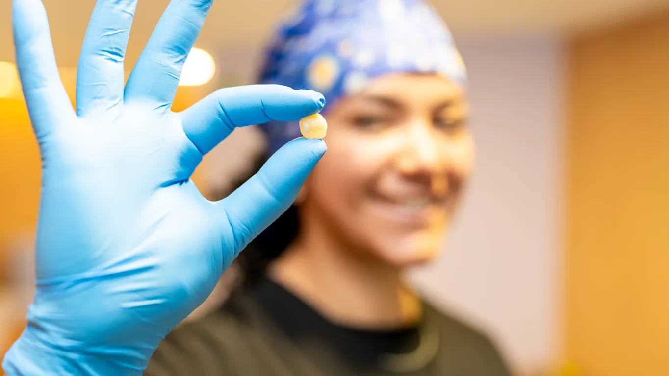 Dentist holding a dental crown close-up during a restorative visit at hisonrisa in Mexico City.