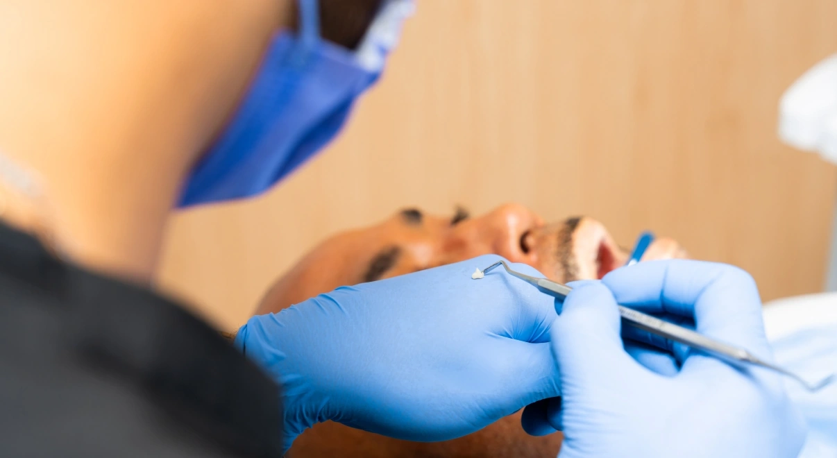 Dentist placing a small tooth-colored composite filling.