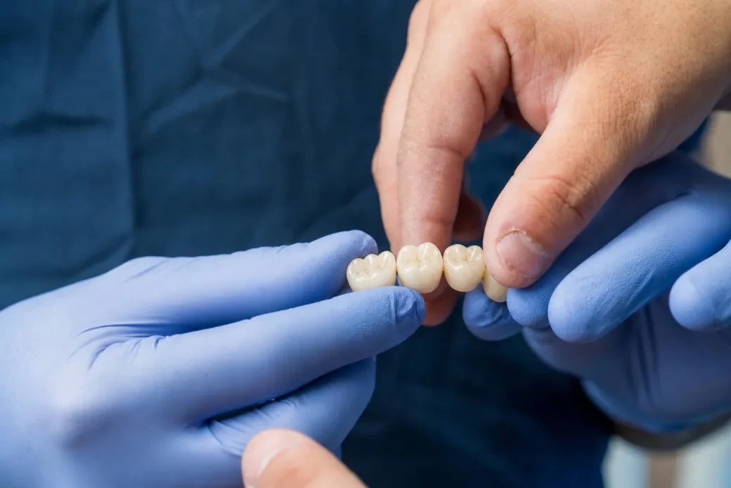 Close-up of gloved hands adjusting a finished dental crown at hisonrisa in Mexico City.