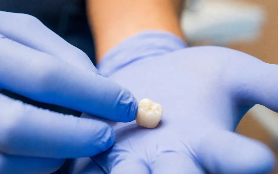 Dental crown held during an explanation of restorative options at hisonrisa in Mexico City.