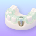 3D icon of guided planning for dental implant placement.