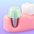 3D icon representing healing time after dental implant surgery.