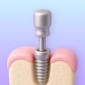 Implant placement with possible extraction planning.