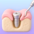 Restorative phase preparation for a dental implant.