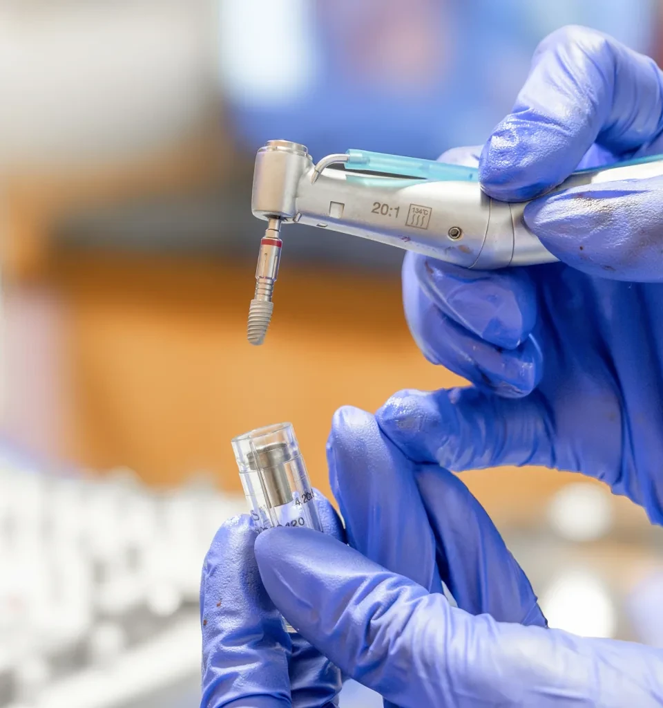 Close-up of a dental implant component prepared for tooth replacement treatment.