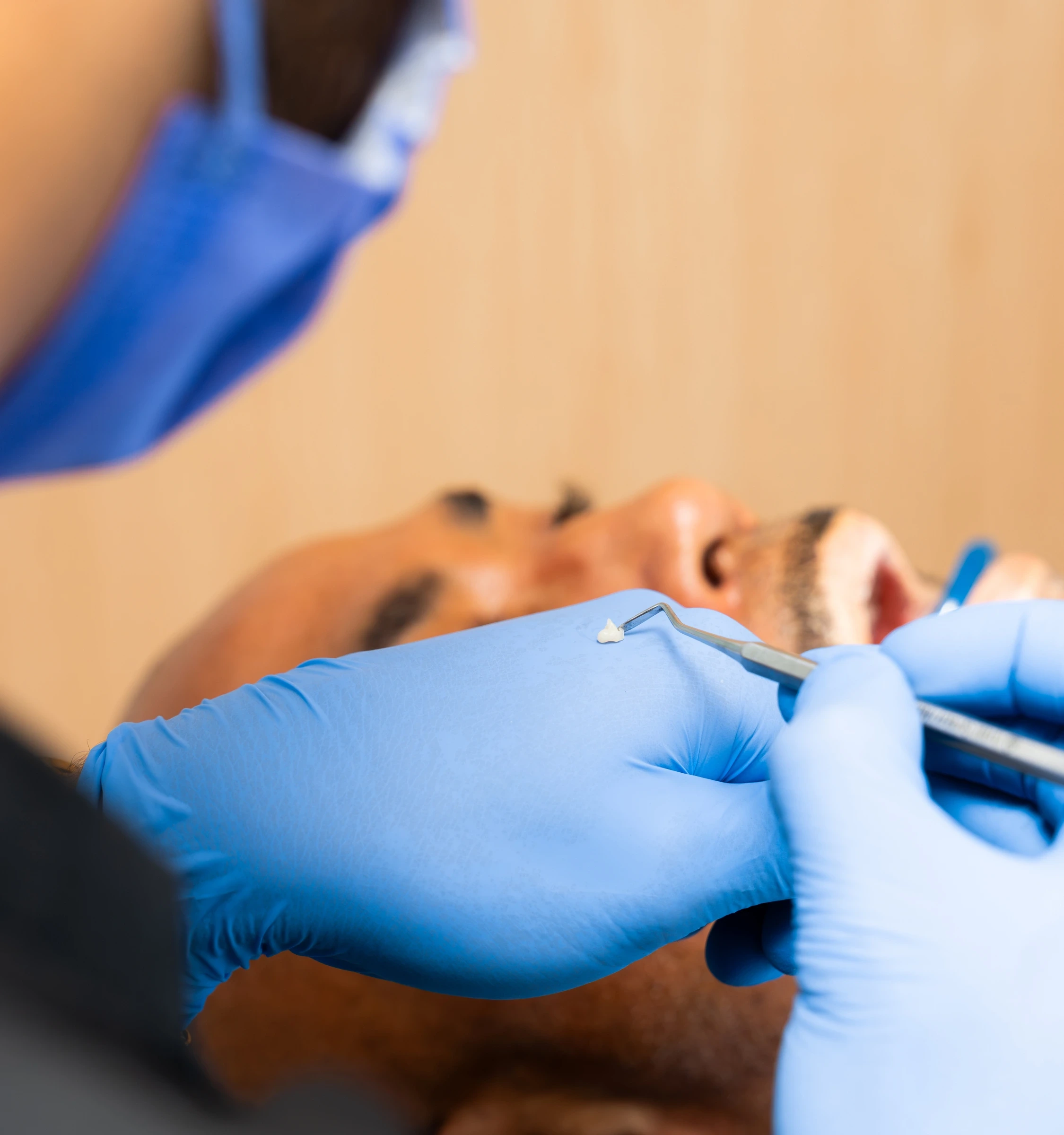 Tooth-colored restoration during a restorative dental visit at hisonrisa in Mexico City.
