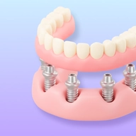 All-on-4 icon with a full-arch implant bridge.