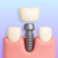 Dental implants icon with an implant and crown.