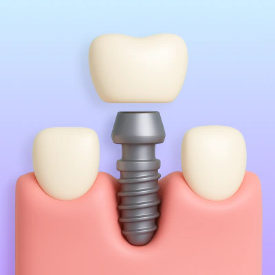 Go to dental implants treatment page