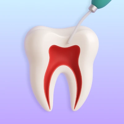 Go to root canal treatment page