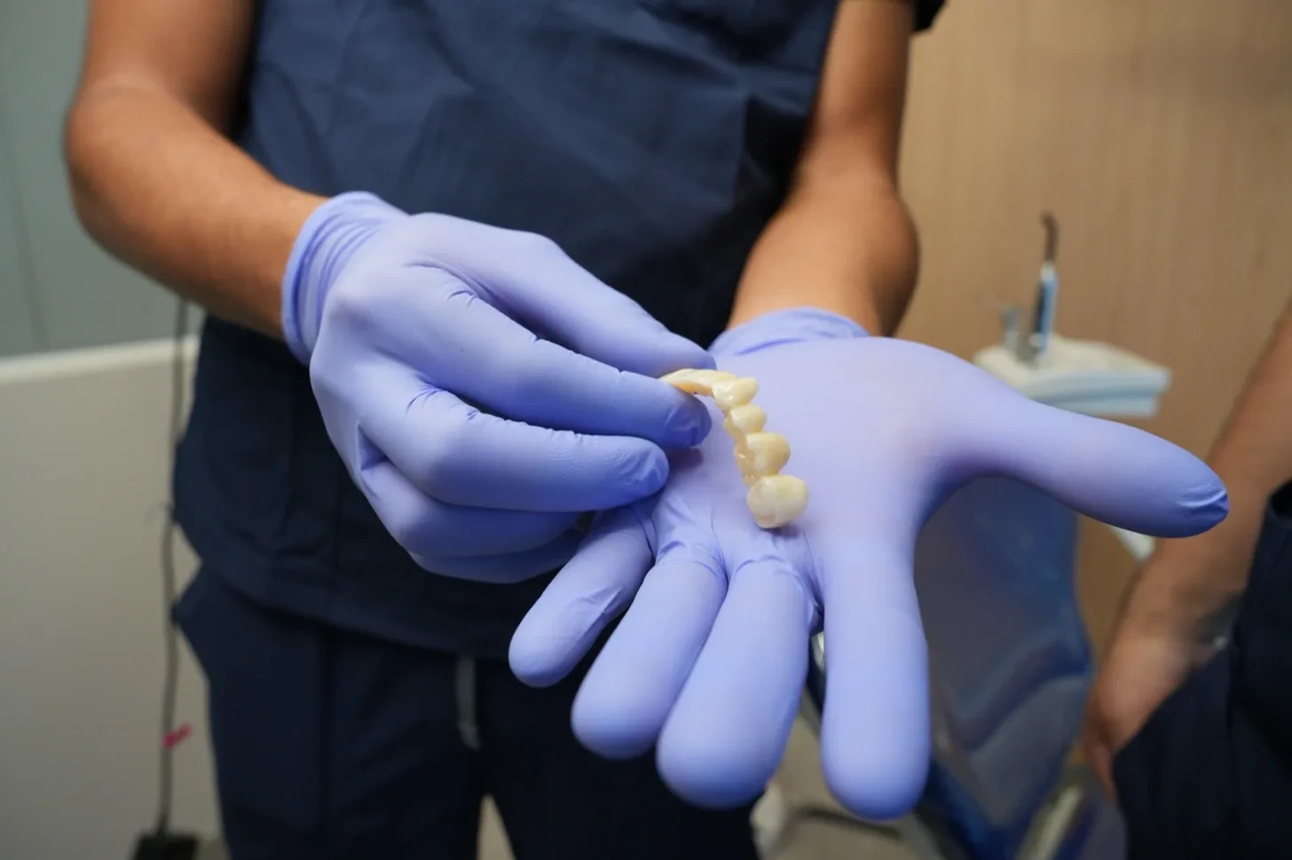 Gloved hand holding a row of joined dental crown units at hisonrisa in Mexico City.