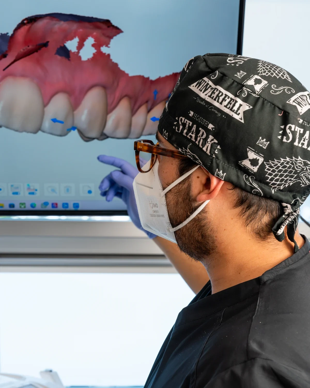 hisonrisa clinician reviewing a digital dental scan for multi-crown planning in Mexico City.