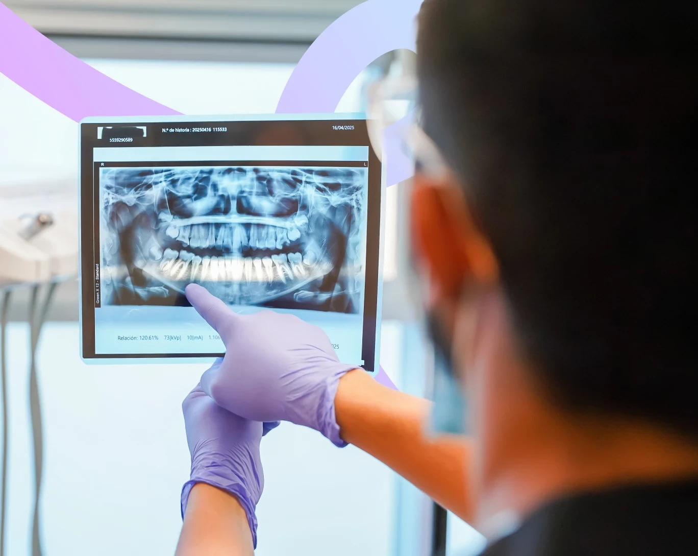 Dentist reviewing a panoramic X-ray for wisdom tooth extraction at hisonrisa in Roma Sur, Mexico City.